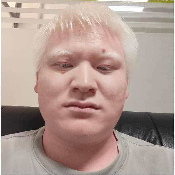 30岁岁安徽单身帅哥 - 残疾人相亲网