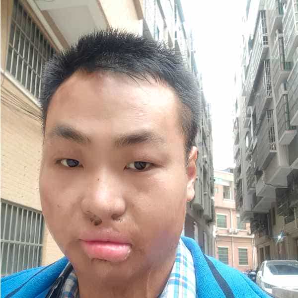 33岁岁湖北单身帅哥 - 残疾人相亲网
