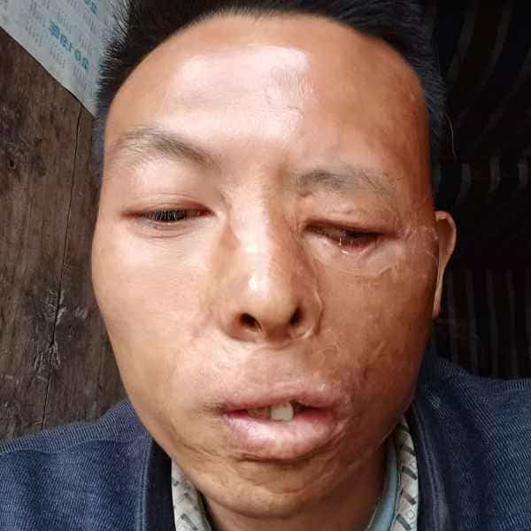 34岁岁四川单身帅哥 - 残疾人相亲网