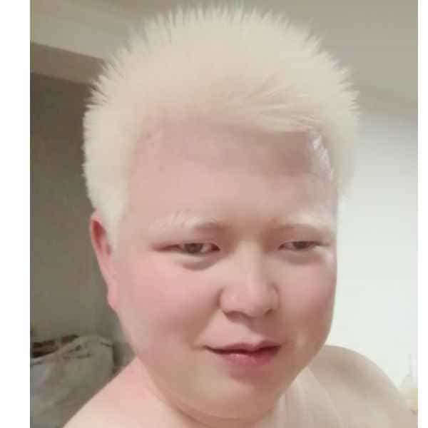 34岁岁陕西单身帅哥 - 残疾人相亲网