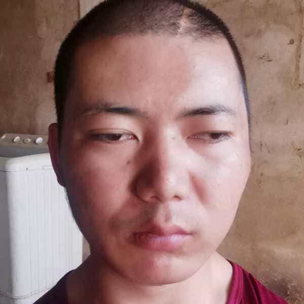 35岁岁云南单身帅哥 - 残疾人相亲网