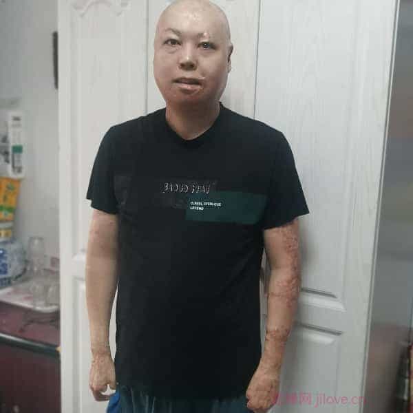 39岁岁河北单身帅哥 - 残疾人相亲网