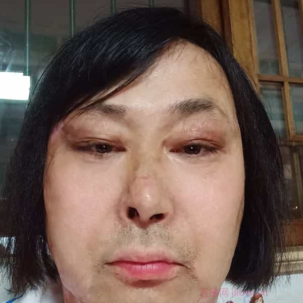 38岁岁山东单身帅哥 - 残疾人相亲网